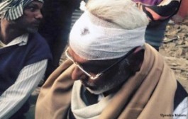 महतोको स्वास्थ्य परिक्षणको रिपोर्ट: एक्स रे सामान्य, भिटामिनको कमीले कमजोरी