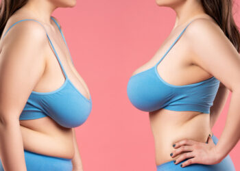 खुकुलो स्तनले आत्मविश्वास घटाएको छ? यसरी छान्नुस् सही ‘ब्रा’